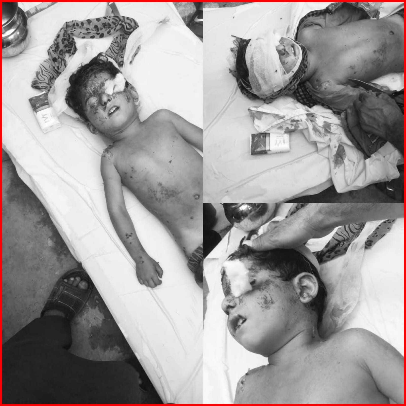 سریاب روڈ پر آوارہ کتوں کے غول کا حملہ، 8 سالہ معصوم بچہ جاں بحق